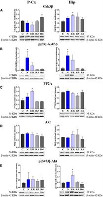 Corrigendum: Synthetic torpor triggers a regulated mechanism in the rat brain, favoring the reversibility of Tau protein hyperphosphorylation